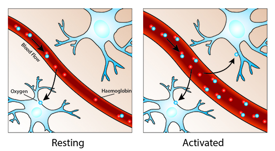 fMRI